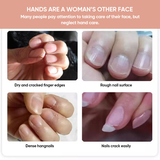 VitalNails™ Revive Damaged Nails