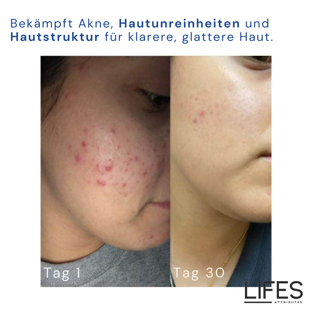 DermaGlanz | Highly Effective Retinol Cream for Radiant Skin