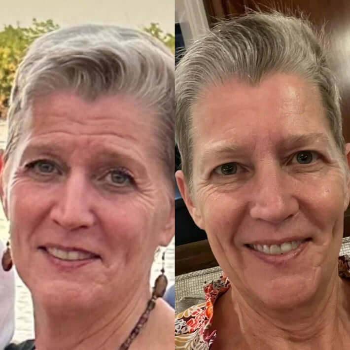 2+2 Free | SmoothPatch™ Wrinkle-Free Confidence