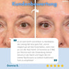 FreshEyes™ Soften Dark Circles In Seconds
