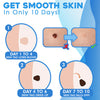 DermFree™ Pain-Free Removal