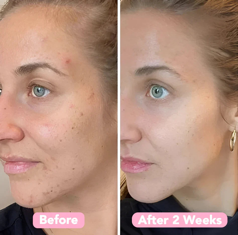 2+2 Free | BrightEase™ Gentle Bright Glow
