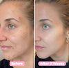 2+2 Free | BrightEase™ Gentle Bright Glow