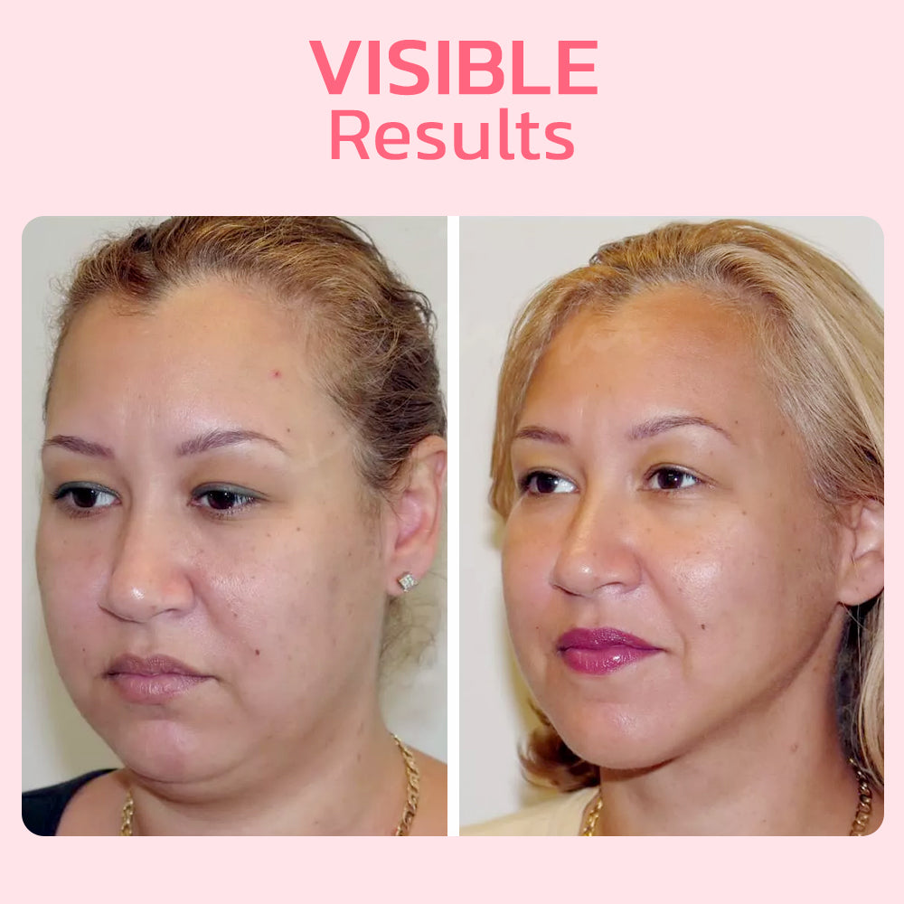 GlowLift™ Sculpted Jawline Enhancer