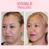 GlowLift™ Sculpted Jawline Enhancer