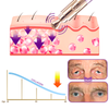 TheraPen™ Therapy Electric Serum Pen