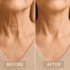 NeckAlign™ Soothe Daily Strain