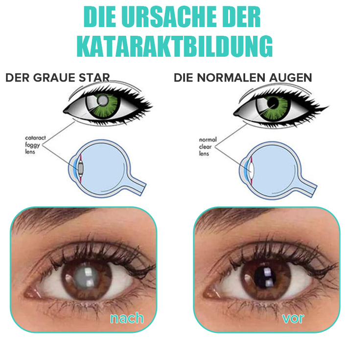 EyeRelief™ Soothe Irritated Eyes