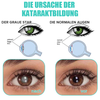 EyeRelief™ Soothe Irritated Eyes
