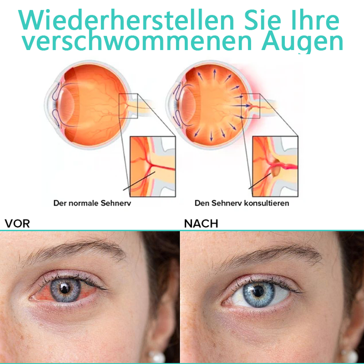 EyeRelief™ Soothe Irritated Eyes