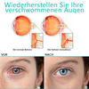 EyeRelief™ Soothe Irritated Eyes