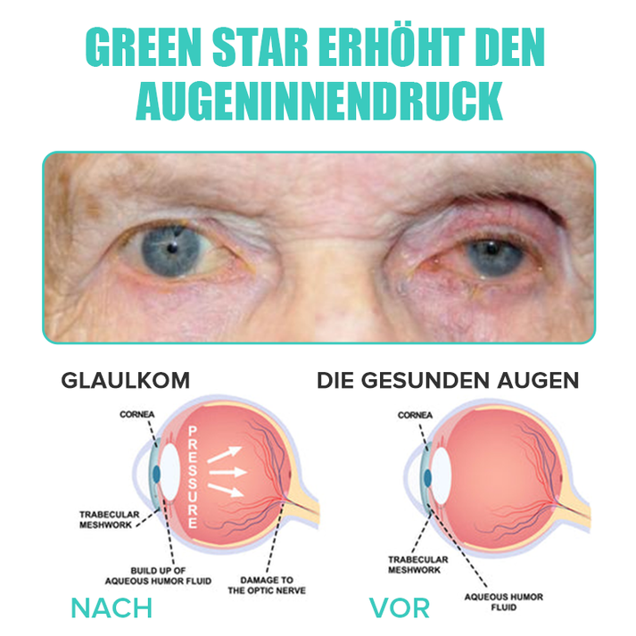 EyeRelief™ Soothe Irritated Eyes
