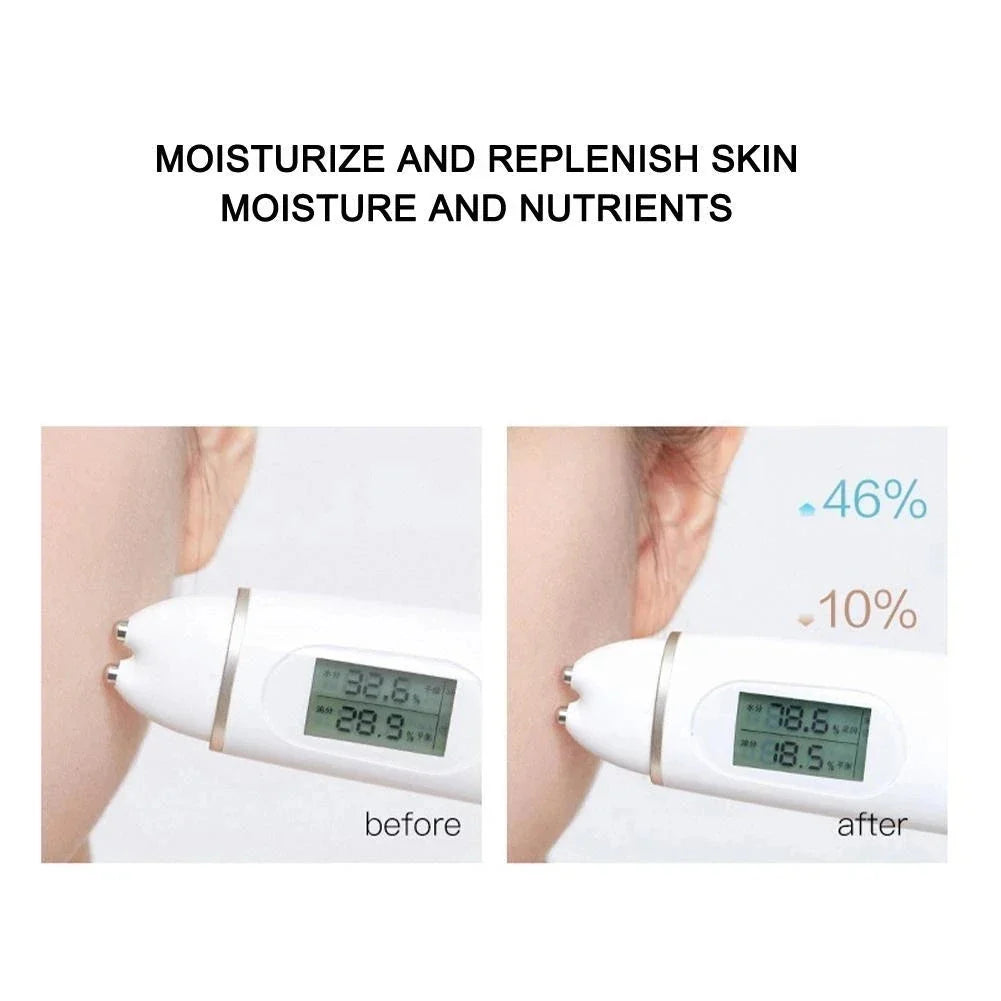 RadiantFirm™ Collagen Botox Threads