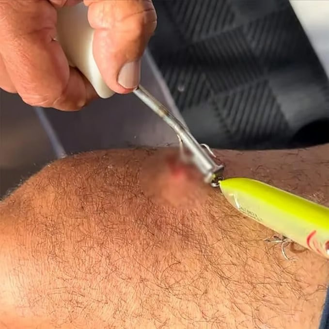 2+1` Free | HookOut™ Safe Hook Removal